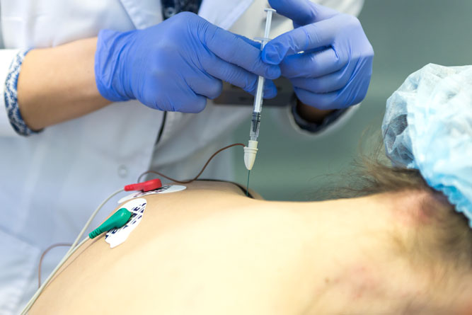 Ботулинотерапия